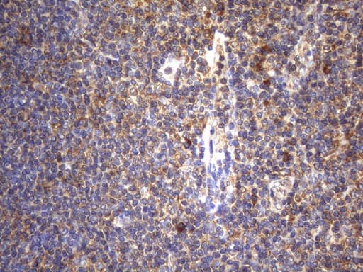CYTH2 / Cytohesin 2 Antibody (clone OTI4D9)