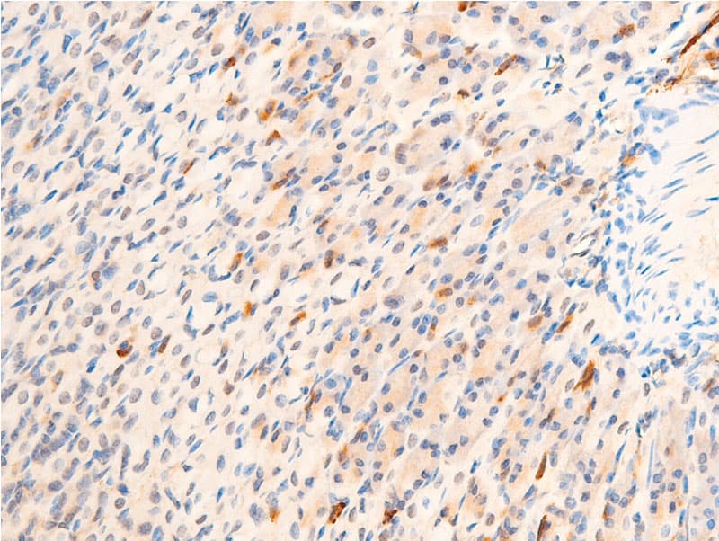 GSK3B / GSK3 Beta Antibody (phospho-Ser9)