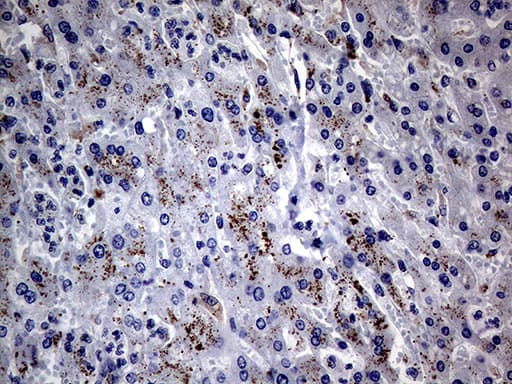 CFI / Complement Factor I Antibody (aa340-583, clone OTI7C8)