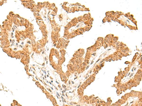 FANCB / FAB Antibody
