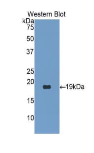 PCOLCE2 Antibody (aa154-269, PE)