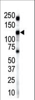 INSRR Antibody (aa16-47)