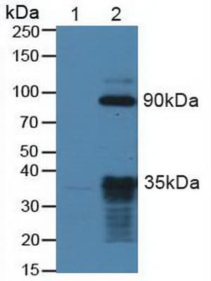 NTRK2 / TRKB Antibody (aa32-430)