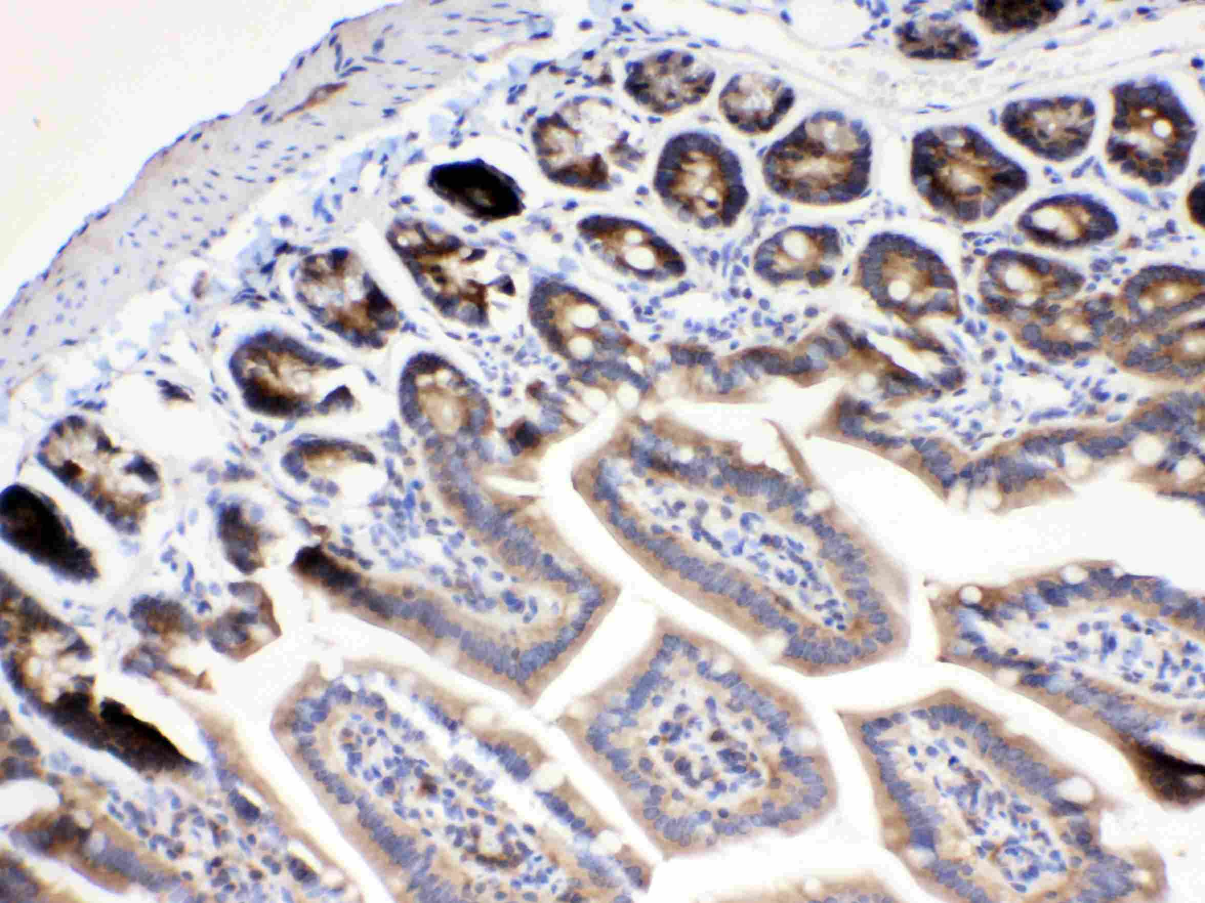 Polyclonal Rabbit anti-Human RANBP1 Antibody (IHC, WB)
