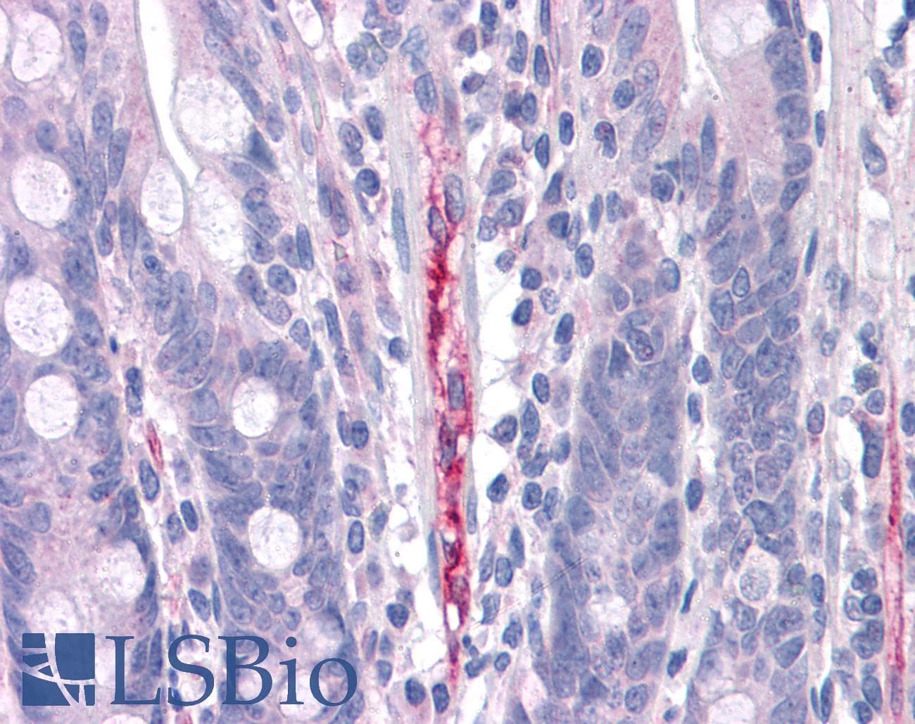 IHC-plus™ Fibulin-3 / EFEMP1 Antibody
