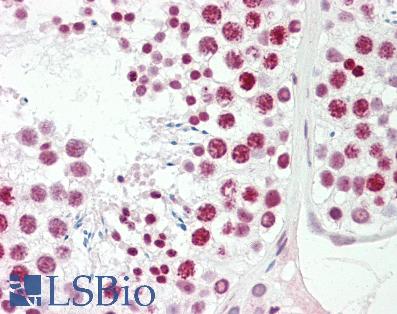 IHC-plus™ Polyclonal Rabbit anti-Human FOXL1 Antibody (aa94-119, IHC, WB)