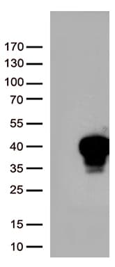 MLX / TCFL4 Antibody (clone OTI1D11, Carrier-free)