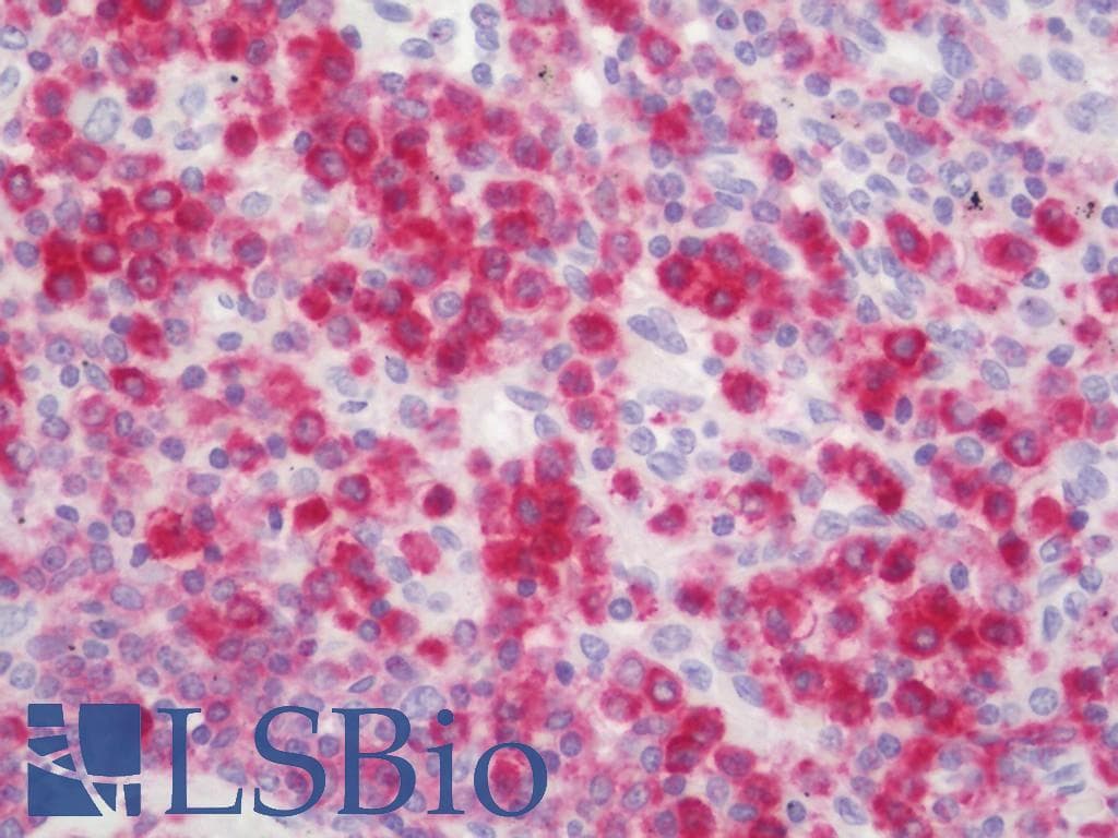 IHC-plus™ CYBA / p22phox Antibody