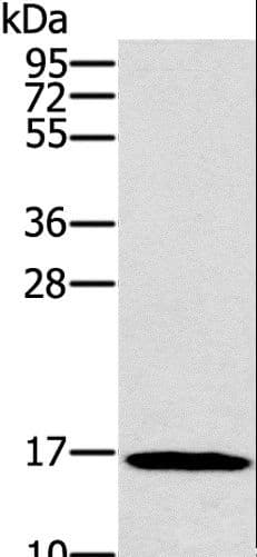 SNCG / Gamma-Synuclein Antibody