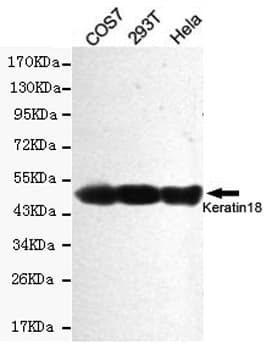 KRT18 / CK18 / Cytokeratin 18 Antibody