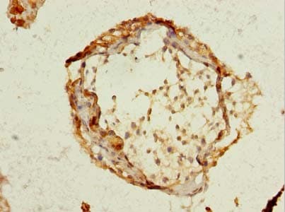 Polyclonal Rabbit anti-Human SCRG1 Antibody (IHC)