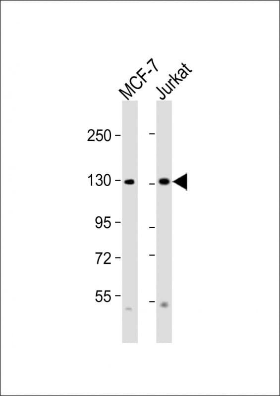 Polyclonal Rabbit anti-Human CTCF Antibody (aa334-364, IHC, WB)