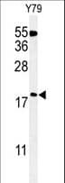 TXNDC12 Antibody (aa144-172)