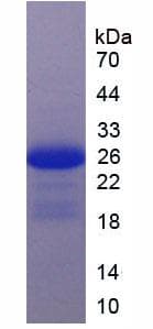 Human IL17RC Protein (Recombinant His, N-Terminal)