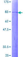 Human DEPDC7 Protein (Recombinant GST)