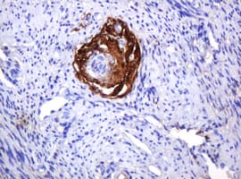 PARVB Antibody (clone OTI3G1)