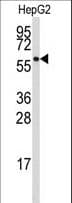 Polyclonal Rabbit anti-Human P5CDH / ALDH4A1 Antibody (aa288-314, IHC, WB)