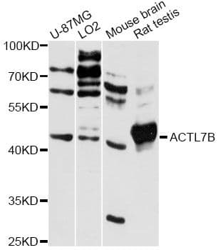 Polyclonal Rabbit anti-Human ACTL7B Antibody (WB)