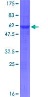 Human EID1 / EID-1 Protein (Recombinant GST)