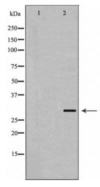 KCNIP3 / Dream / Calsenilin Antibody