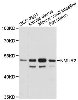Polyclonal Rabbit anti-Human NMUR2 Antibody (WB)