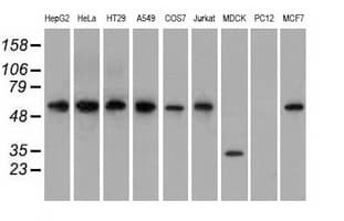 Monoclonal Mouse anti-Human GPI Antibody (clone OTI2D2, IHC, IF, WB)