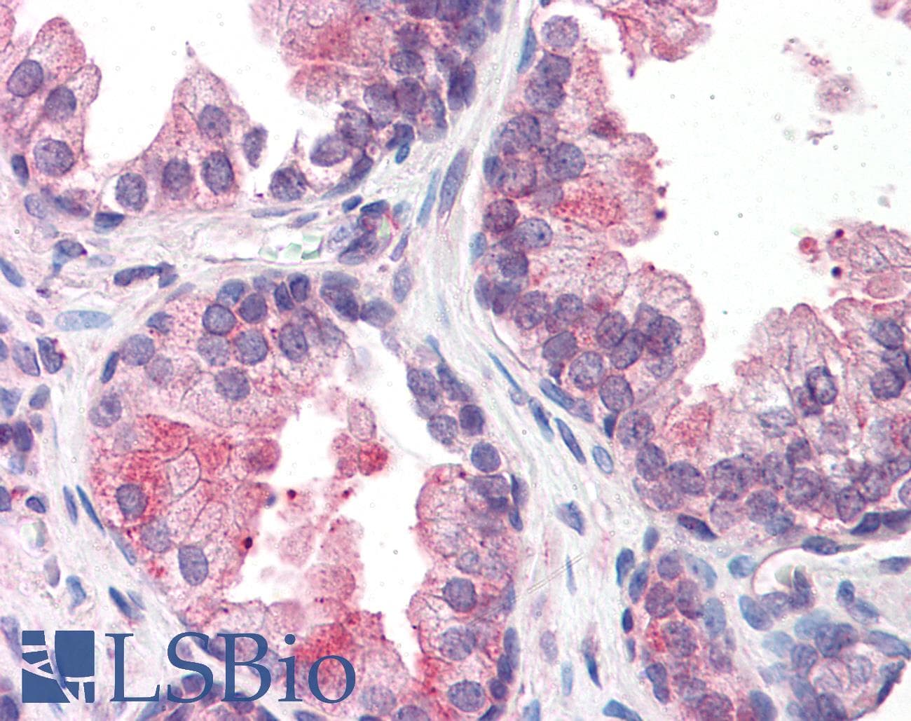 Polyclonal Rabbit anti-Human BAF60B / SMARCD2 Antibody (aa431-480, IHC, WB)