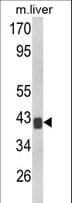 TOB1 / TOB Antibody (aa54-83)