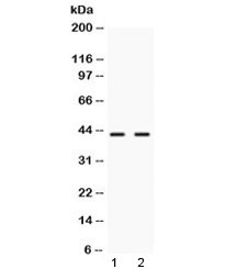EAR2 / NR2F6 Antibody