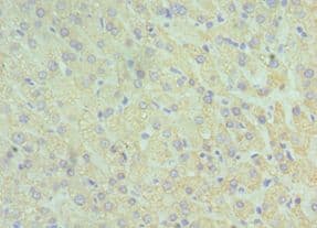 IHC-plus™ GLUD2 Antibody (aa319-558)