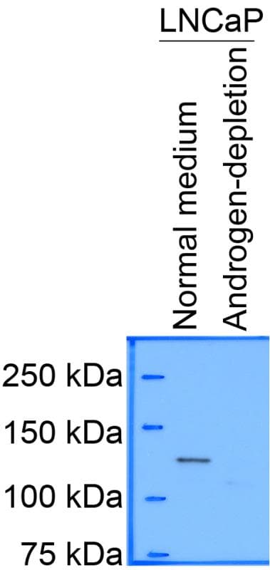 Polyclonal Rabbit anti-Human HDAC5 Antibody (aa1-100, IHC, IF, WB)