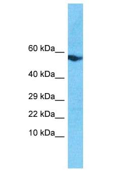 Polyclonal Rabbit anti-Human SOHLH2 Antibody (aa30-79, WB)