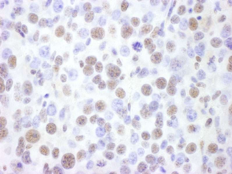 Polyclonal Goat anti-Human SMARCA4 / BRG1 Antibody (aa50-100, IHC, WB)