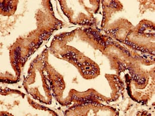 Polyclonal Rabbit anti-Human CTP Synthetase 2 / CTPS2 Antibody