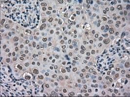 TMEM100 Antibody (clone OTI1F8)