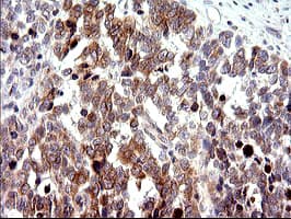 Monoclonal Mouse anti-Human CHAC1 / MGC4504 Antibody (clone OTI1E2, Carrier-free, IHC, IF, WB)