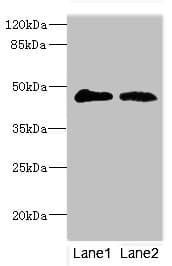 GCNT2 Antibody