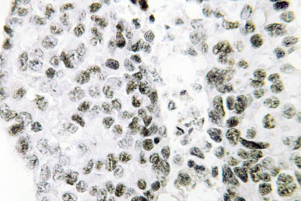 Polyclonal Rabbit anti-Human SNAI1 / SNAIL-1 Antibody (Ala242, IHC, IF, WB)