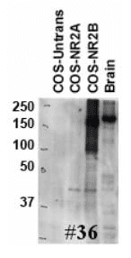 GRIN2B / NMDAR2B / NR2B Antibody (aa20-271, clone S59-36)