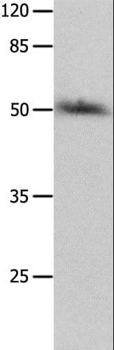 P2RY2 / P2Y2 Antibody (aa353-366)