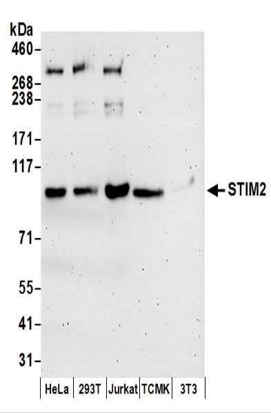 Polyclonal Rabbit anti-Human STIM2 Antibody (aa600-650, WB)