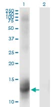 Monoclonal Mouse anti-Human Mineralocorticoid Receptor Antibody (clone 2B5, WB)