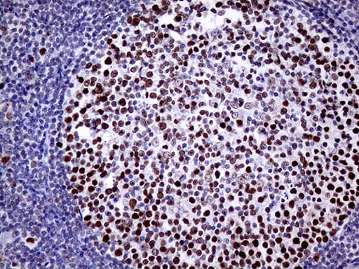 TOP1 / Topoisomerase I Antibody (aa93-151, clone OTI3B9)