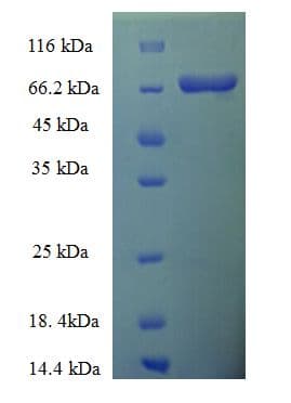 Human NR1A2 / THRB Protein (Recombinant His-SUMO)