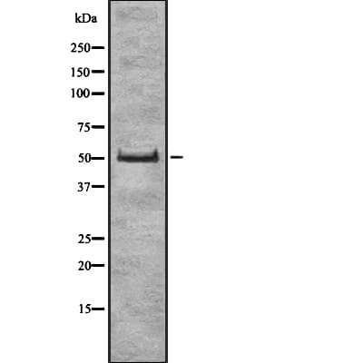 Polyclonal Rabbit anti-Human EIF3E Antibody (WB)