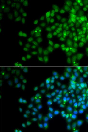EPC1 Antibody