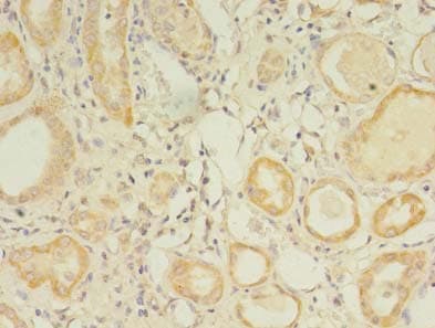 Polyclonal Rabbit anti-Human GPC4 / Glypican 4 Antibody (IHC, WB)