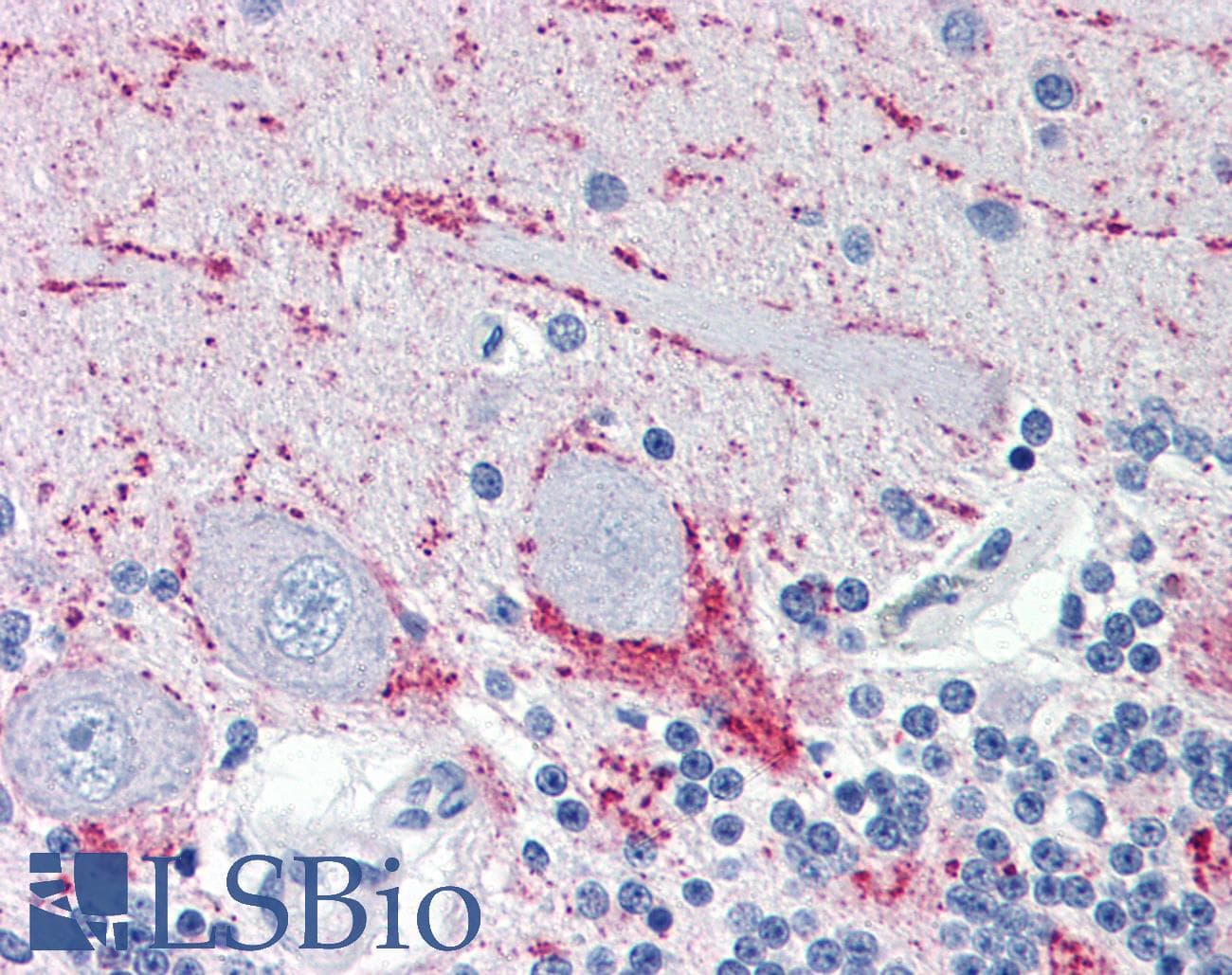IHC-plus™ VAMP2 / VAMP-2 Antibody (aa1-89, clone 3E5)