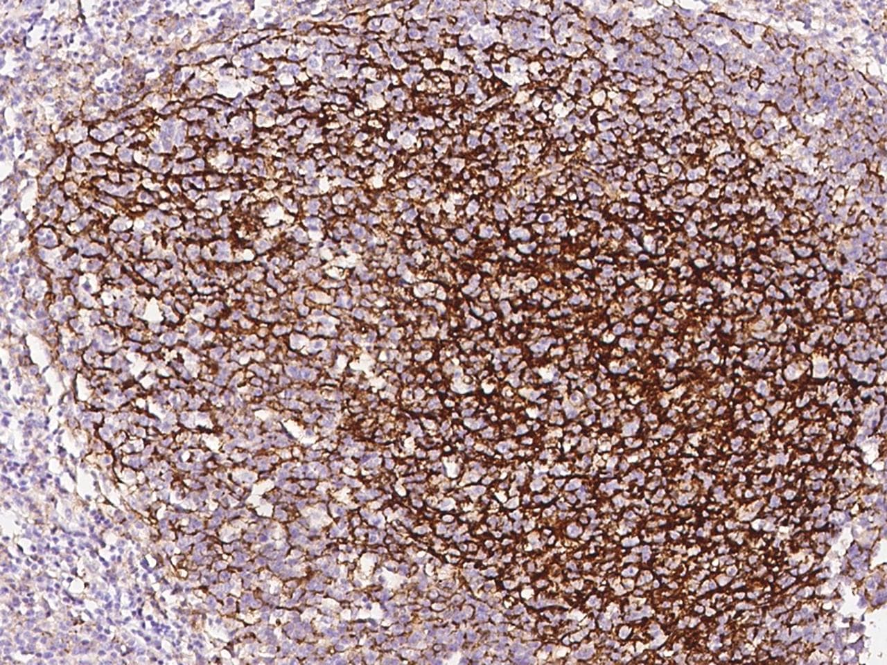 CR2 / CD21 Antibody