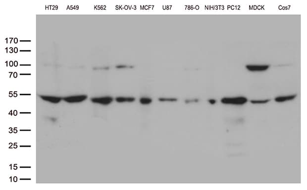 DNPEP Antibody (clone OTI8H3)